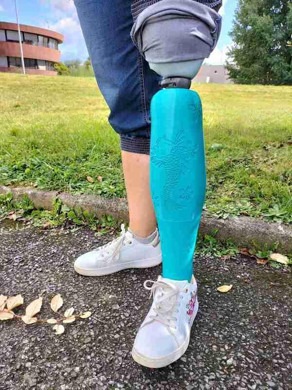 🦿 Une cover de prothèse de jambe personnalisée pour les vacances de Séverine à la plage 🏖️ update